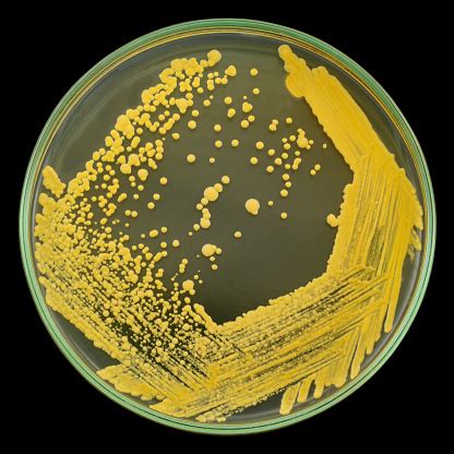 yellow bacterial colonies on agar